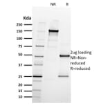 SDS-PAGE - Anti-Integrin beta 3 Antibody [ITGB3/2597] - BSA and Azide free (A252263) - Antibodies.com