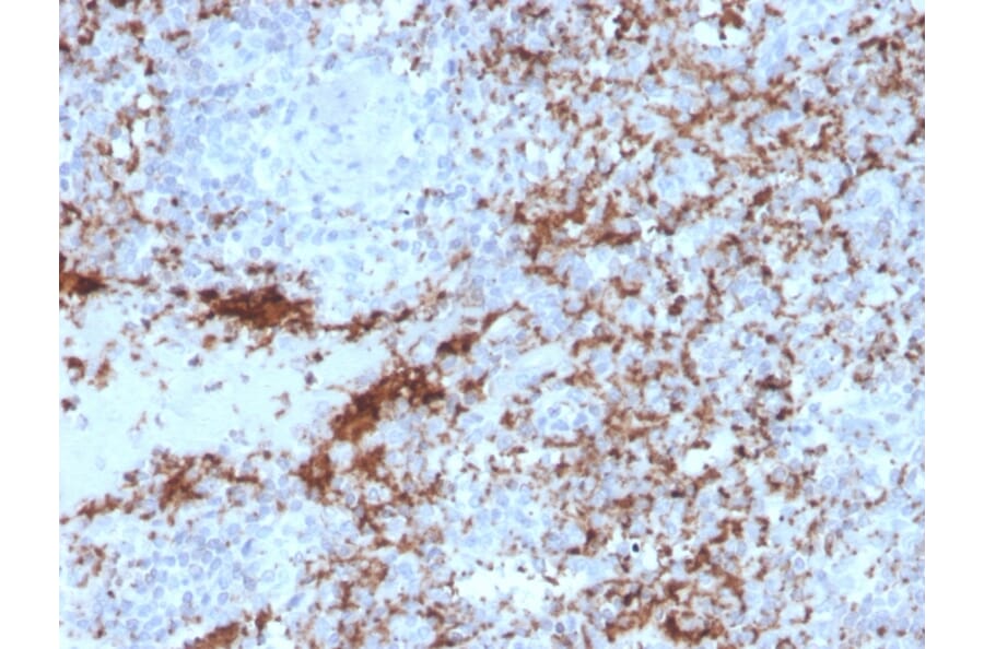 Immunohistochemistry - Anti-Integrin beta 3 Antibody [rITGB3/2145] - BSA and Azide free (A252263) - Antibodies.com