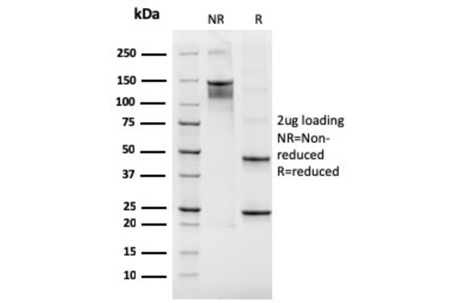 SDS-PAGE - Anti-Integrin beta 3 Antibody [rITGB3/2145] - BSA and Azide free (A252264) - Antibodies.com