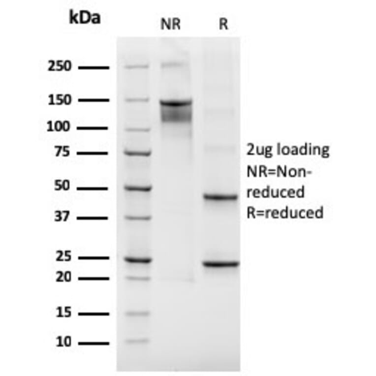 SDS-PAGE - Anti-Integrin beta 3 Antibody [rITGB3/2145] - BSA and Azide free (A252264) - Antibodies.com