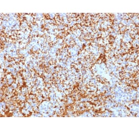 Immunohistochemistry - Anti-Integrin beta 3 Antibody [ITGB3/2166R] - BSA and Azide free (A252265) - Antibodies.com