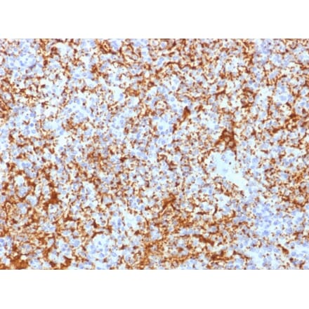 Immunohistochemistry - Anti-Integrin beta 3 Antibody [ITGB3/2166R] - BSA and Azide free (A252265) - Antibodies.com