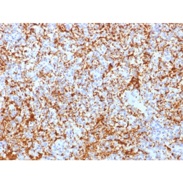 Immunohistochemistry - Anti-Integrin beta 3 Antibody [ITGB3/2166R] - BSA and Azide free (A252265) - Antibodies.com