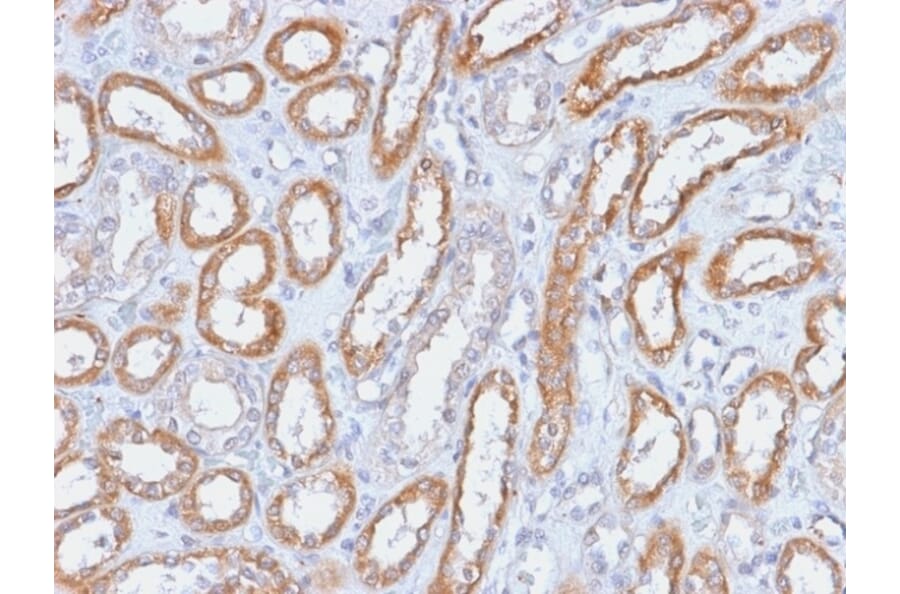 Immunohistochemistry - Anti-Integrin beta 3 Antibody [ITGB3/2166R] - BSA and Azide free (A252264) - Antibodies.com
