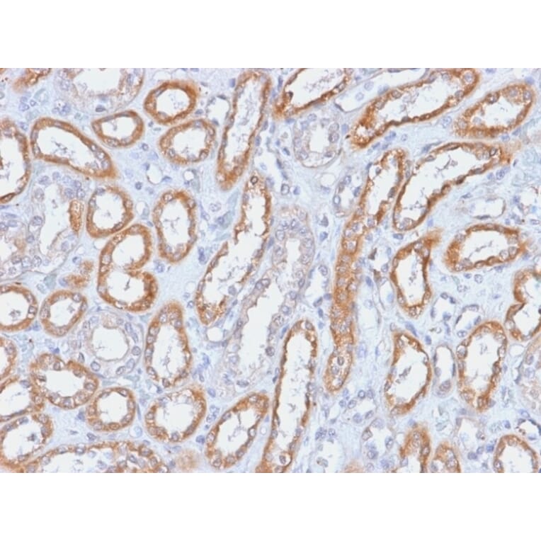 Immunohistochemistry - Anti-Integrin beta 3 Antibody [ITGB3/2166R] - BSA and Azide free (A252264) - Antibodies.com