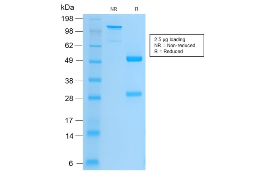SDS-PAGE - Anti-Integrin beta 3 Antibody [ITGB3/2166R] - BSA and Azide free (A252265) - Antibodies.com