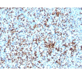 Immunohistochemistry - Anti-Integrin beta 3 Antibody [ITGB3/3126R] - BSA and Azide free (A252265) - Antibodies.com