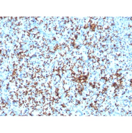 Immunohistochemistry - Anti-Integrin beta 3 Antibody [ITGB3/3126R] - BSA and Azide free (A252265) - Antibodies.com