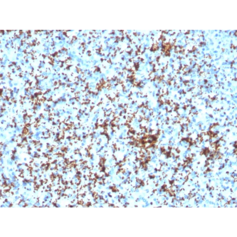 Immunohistochemistry - Anti-Integrin beta 3 Antibody [ITGB3/3126R] - BSA and Azide free (A252265) - Antibodies.com