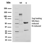 SDS-PAGE - Anti-Integrin beta 3 Antibody [ITGB3/3126R] - BSA and Azide free (A252266) - Antibodies.com