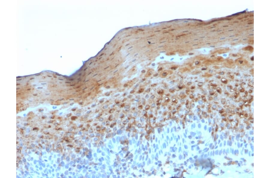Immunohistochemistry - Anti-Involucrin Antibody [SY5] - BSA and Azide free (A252267) - Antibodies.com