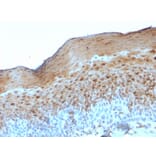 Immunohistochemistry - Anti-Involucrin Antibody [SY5] - BSA and Azide free (A252267) - Antibodies.com