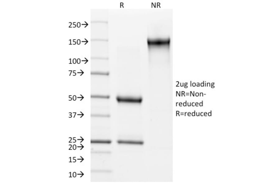 SDS-PAGE - Anti-Involucrin Antibody [SY5] - BSA and Azide free (A252268) - Antibodies.com