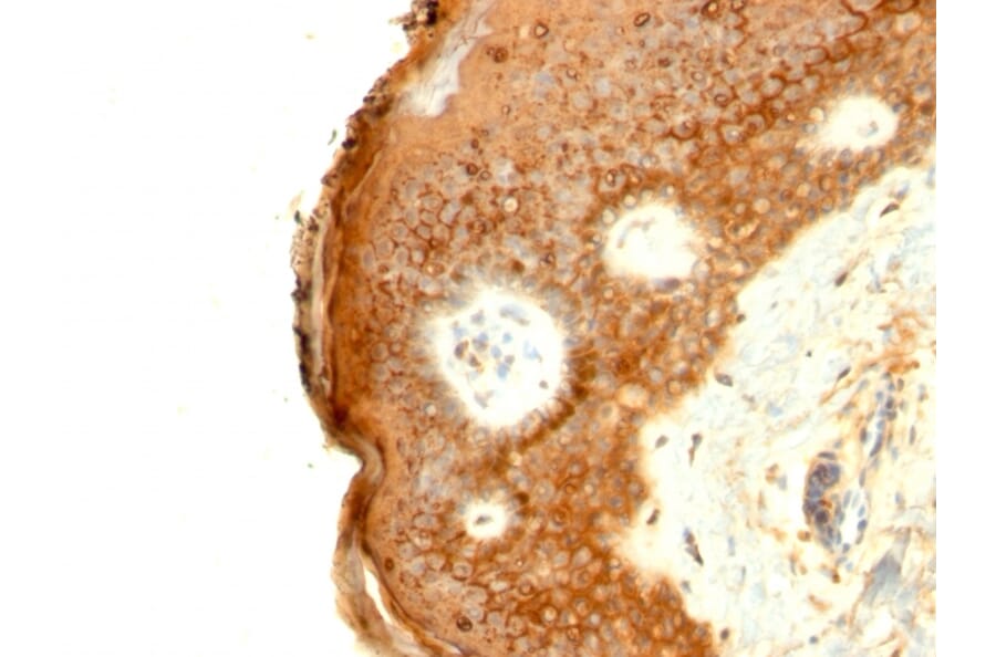 Immunohistochemistry - Anti-Involucrin Antibody [SPM259] - BSA and Azide free (A252268) - Antibodies.com