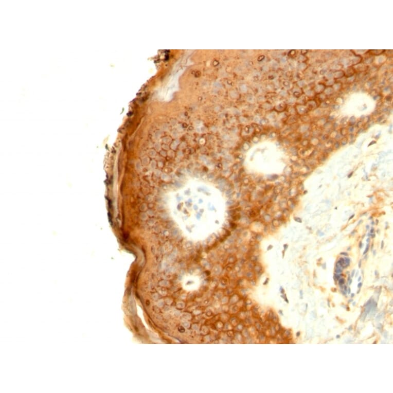 Immunohistochemistry - Anti-Involucrin Antibody [SPM259] - BSA and Azide free (A252268) - Antibodies.com