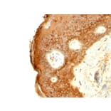 Immunohistochemistry - Anti-Involucrin Antibody [SPM259] - BSA and Azide free (A252268) - Antibodies.com