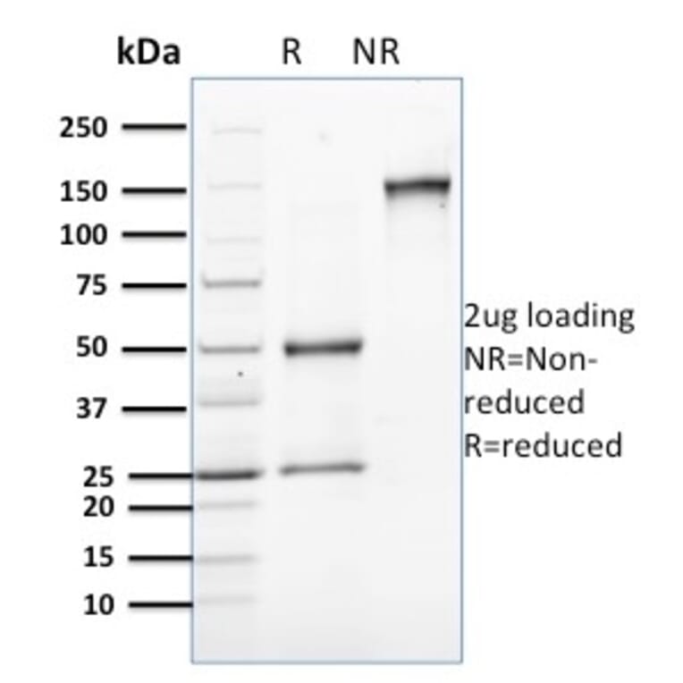 SDS-PAGE - Anti-Involucrin Antibody [SPM259] - BSA and Azide free (A252269) - Antibodies.com