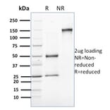SDS-PAGE - Anti-Involucrin Antibody [SPM259] - BSA and Azide free (A252269) - Antibodies.com