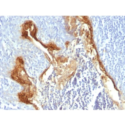 Immunohistochemistry - Anti-Involucrin Antibody [IVRN/827] - BSA and Azide free (A252269) - Antibodies.com