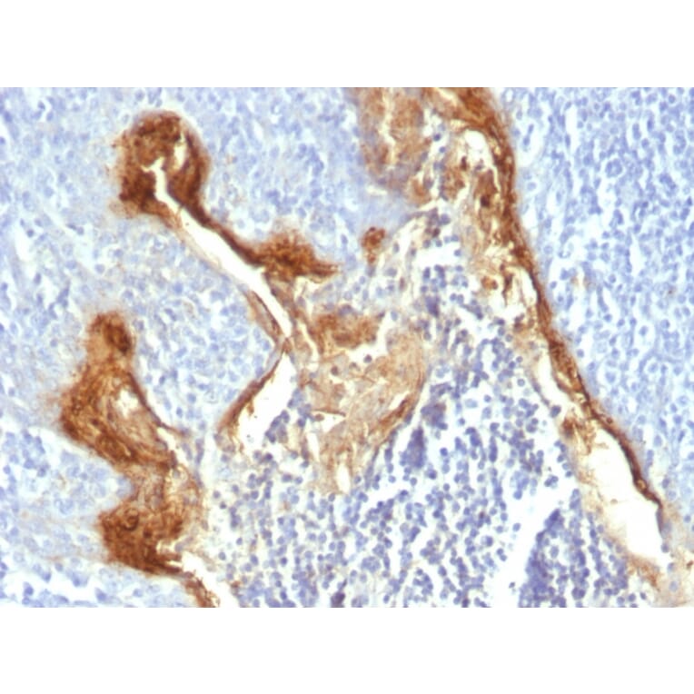 Immunohistochemistry - Anti-Involucrin Antibody [IVRN/827] - BSA and Azide free (A252269) - Antibodies.com