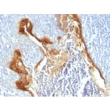 Immunohistochemistry - Anti-Involucrin Antibody [IVRN/827] - BSA and Azide free (A252269) - Antibodies.com