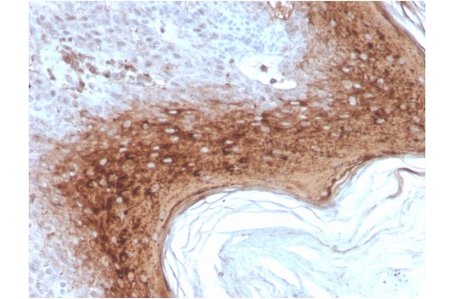 Immunohistochemistry - Anti-Involucrin Antibody [rIVRN/827] - BSA and Azide free (A252270) - Antibodies.com
