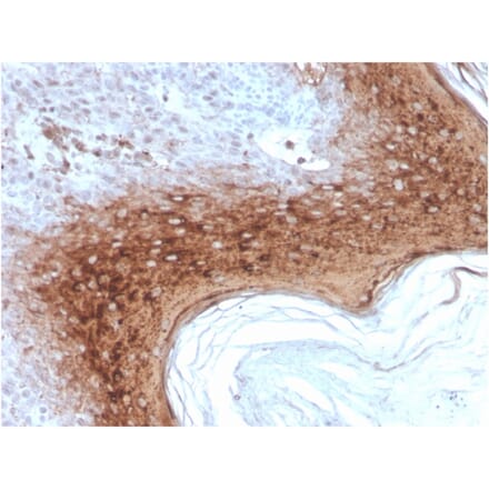 Immunohistochemistry - Anti-Involucrin Antibody [rIVRN/827] - BSA and Azide free (A252270) - Antibodies.com