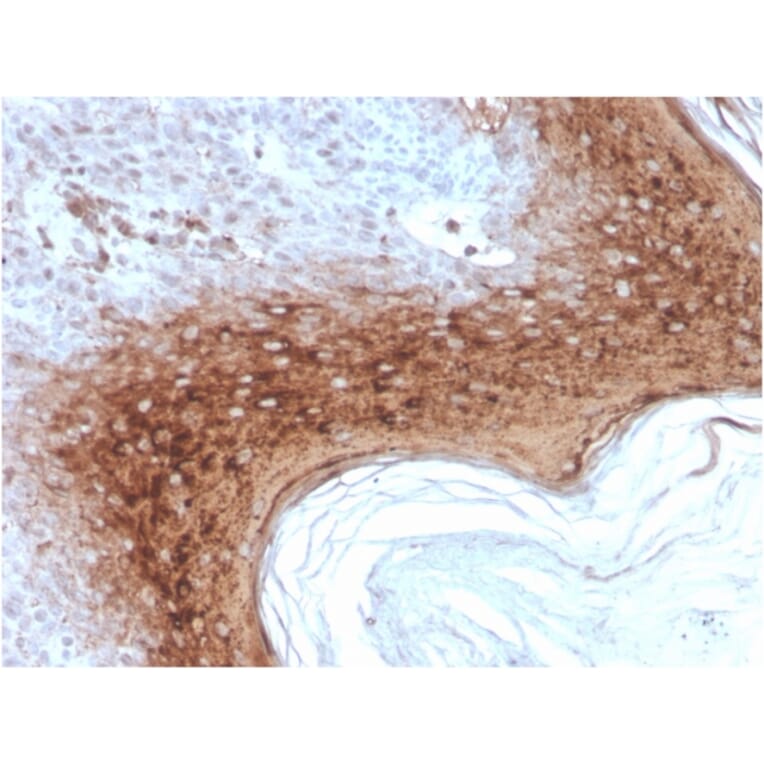 Immunohistochemistry - Anti-Involucrin Antibody [rIVRN/827] - BSA and Azide free (A252270) - Antibodies.com