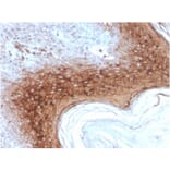 Immunohistochemistry - Anti-Involucrin Antibody [rIVRN/827] - BSA and Azide free (A252270) - Antibodies.com