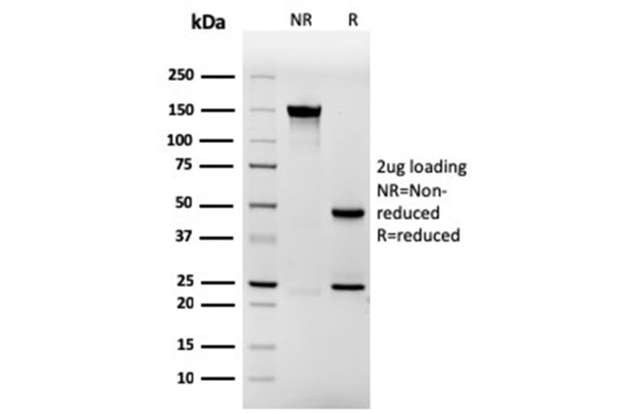 SDS-PAGE - Anti-Involucrin Antibody [rIVRN/827] - BSA and Azide free (A252271) - Antibodies.com