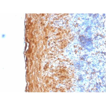 Immunohistochemistry - Anti-Involucrin Antibody [IVRN/2113R] - BSA and Azide free (A252271) - Antibodies.com