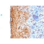 Immunohistochemistry - Anti-Involucrin Antibody [IVRN/2113R] - BSA and Azide free (A252271) - Antibodies.com