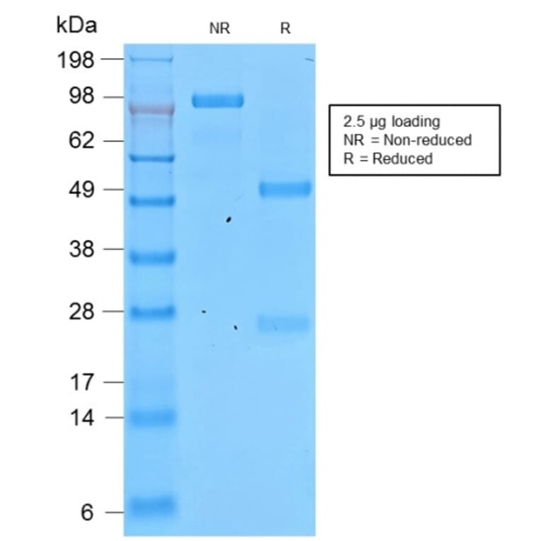 SDS-PAGE - Anti-Involucrin Antibody [IVRN/2113R] - BSA and Azide free (A252272) - Antibodies.com