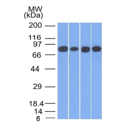 Western Blot - Anti-gamma Catenin Antibody [11E4] - BSA and Azide free (A252276) - Antibodies.com