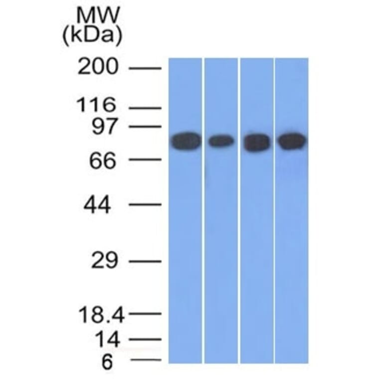 Western Blot - Anti-gamma Catenin Antibody [11E4] - BSA and Azide free (A252276) - Antibodies.com