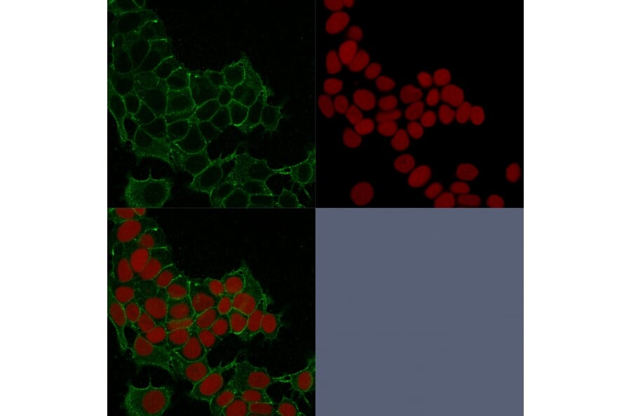 Immunofluorescence - Anti-gamma Catenin Antibody [11E4] - BSA and Azide free (A252276) - Antibodies.com