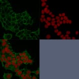 Immunofluorescence - Anti-gamma Catenin Antibody [11E4] - BSA and Azide free (A252276) - Antibodies.com