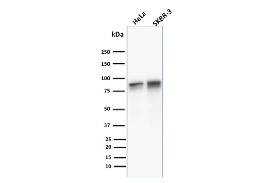 Western Blot - Anti-gamma Catenin Antibody [11E4] - BSA and Azide free (A252276) - Antibodies.com