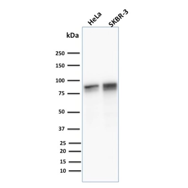 Western Blot - Anti-gamma Catenin Antibody [11E4] - BSA and Azide free (A252276) - Antibodies.com