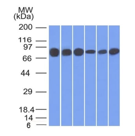 Western Blot - Anti-gamma Catenin Antibody [15F11] - BSA and Azide free (A252277) - Antibodies.com