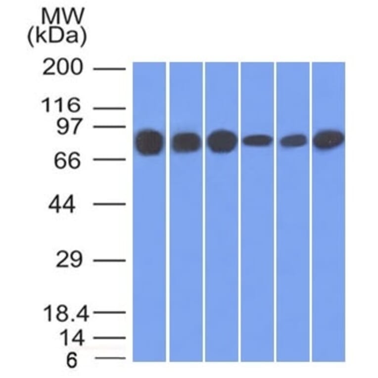 Western Blot - Anti-gamma Catenin Antibody [15F11] - BSA and Azide free (A252277) - Antibodies.com