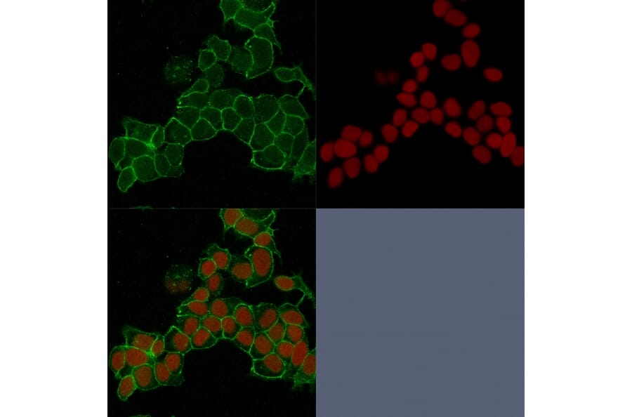 Immunofluorescence - Anti-gamma Catenin Antibody [15F11] - BSA and Azide free (A252277) - Antibodies.com
