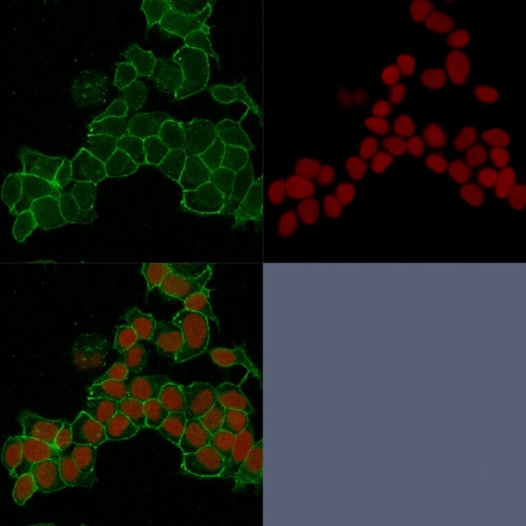 Immunofluorescence - Anti-gamma Catenin Antibody [15F11] - BSA and Azide free (A252277) - Antibodies.com