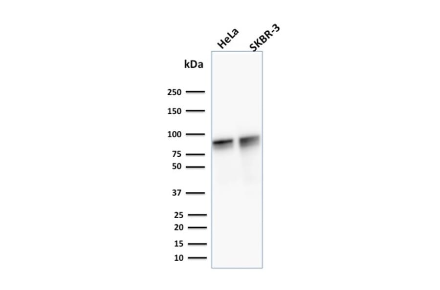Western Blot - Anti-gamma Catenin Antibody [15F11] - BSA and Azide free (A252277) - Antibodies.com