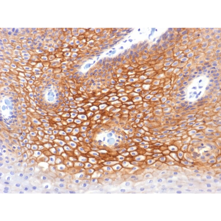 Immunohistochemistry - Anti-gamma Catenin Antibody [CTNG/1483] - BSA and Azide free (A252277) - Antibodies.com