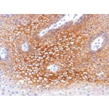 Immunohistochemistry - Anti-gamma Catenin Antibody [CTNG/1483] - BSA and Azide free (A252277) - Antibodies.com