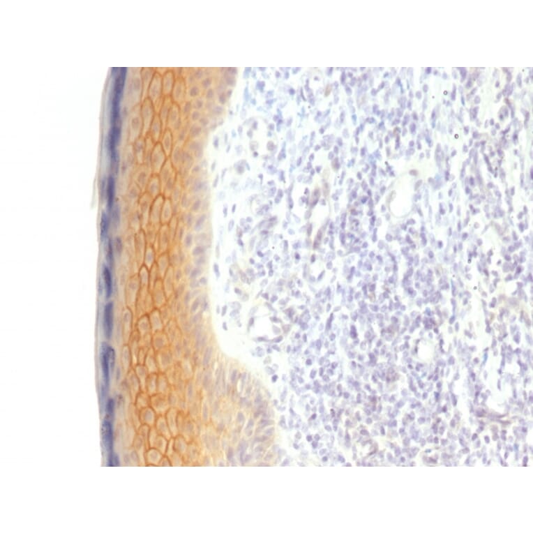 Immunohistochemistry - Anti-gamma Catenin Antibody [CTNG/1483] - BSA and Azide free (A252278) - Antibodies.com