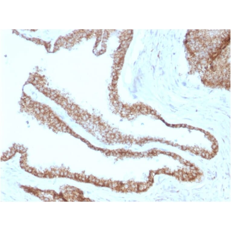 Immunohistochemistry - Anti-gamma Catenin Antibody [CTNG/1664] - BSA and Azide free (A252279) - Antibodies.com