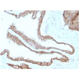 Immunohistochemistry - Anti-gamma Catenin Antibody [CTNG/1664] - BSA and Azide free (A252279) - Antibodies.com