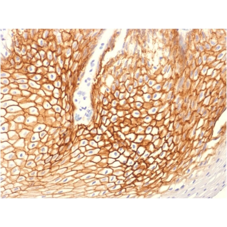 Immunohistochemistry - Anti-gamma Catenin Antibody [CTNG/1664] - BSA and Azide free (A252279) - Antibodies.com